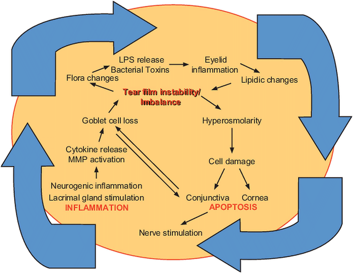 Diagnosing the severity of dry eye: a clear and practical algorithm