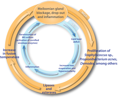 The double vicious cycle in MGD